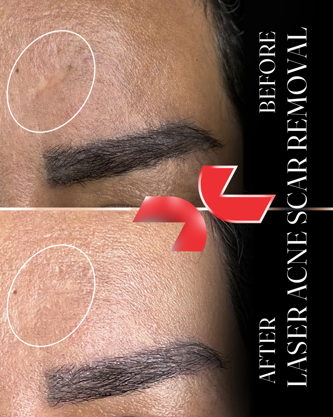 لیزر Dermablate آلمان - Image