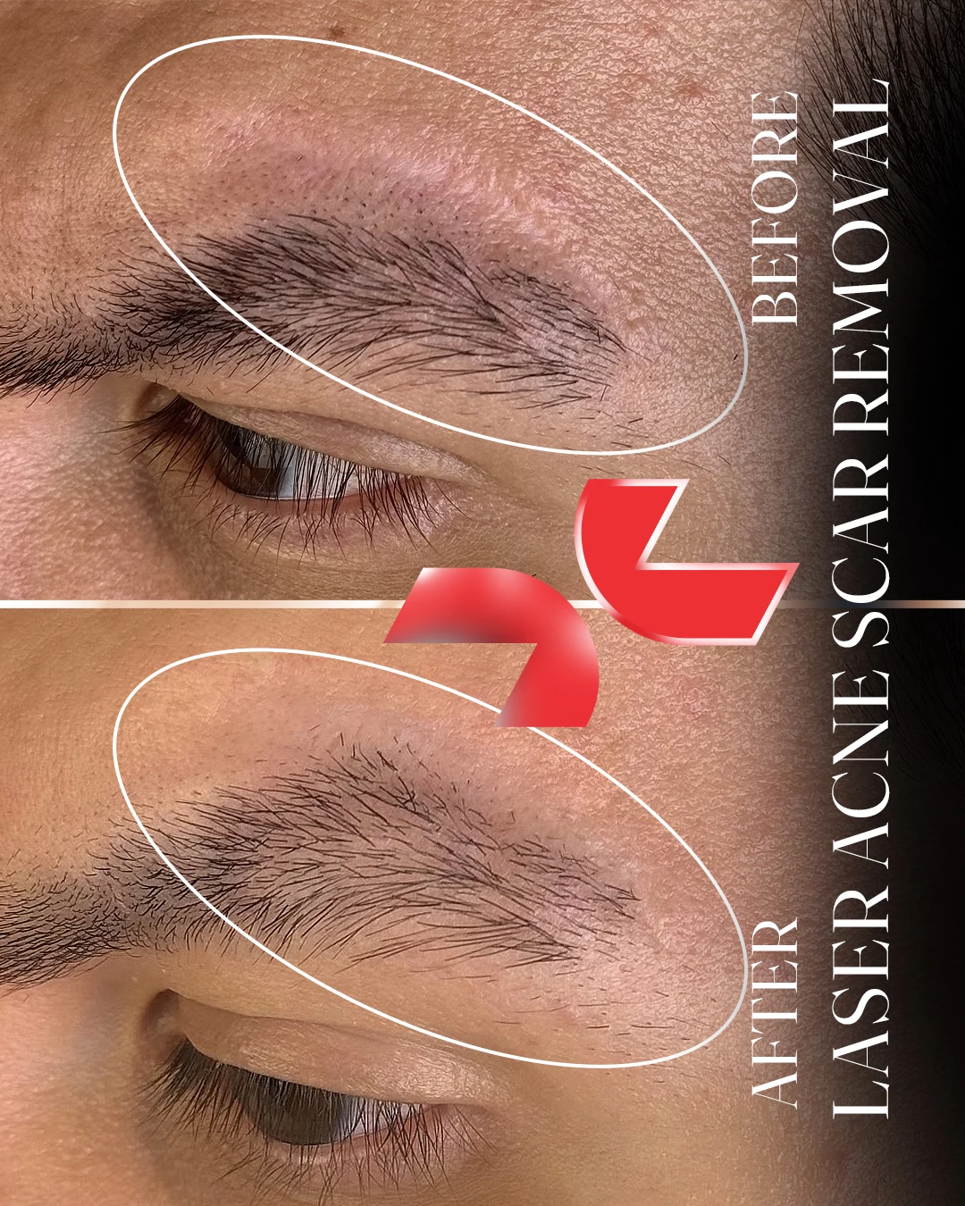 لیزر Dermablate آلمان - Image
