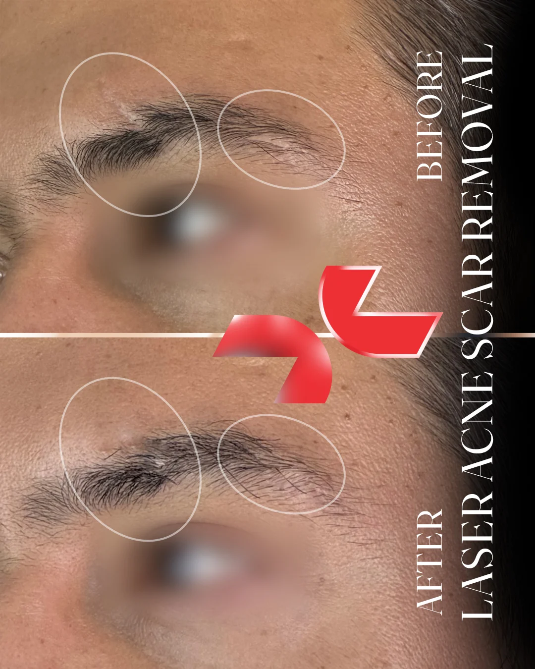 لیزر Dermablate آلمان - Image