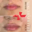 اصلاح فرم لب